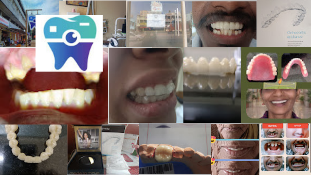 Clinical Showcase Collage - Smile Transformations